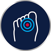 Kliar och svider det mellan tårna?