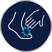 Hudsvamp sprids lätt vid hud-mot-hudkontakt